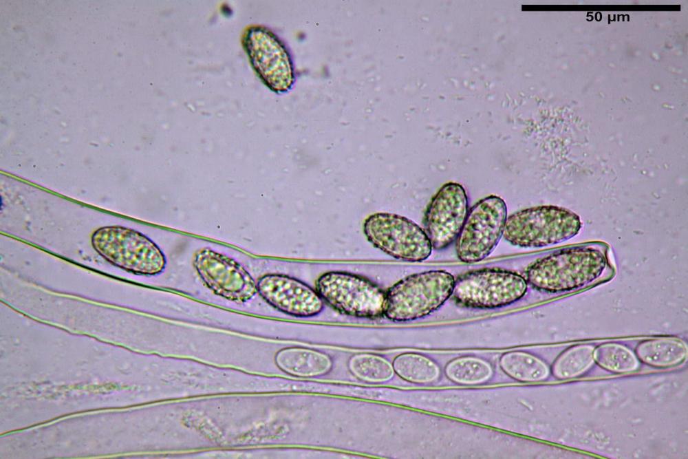Scutellinia cejpii 076.jpg