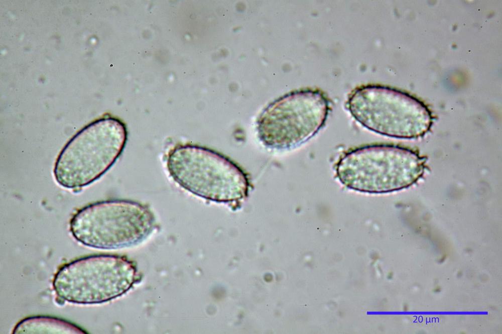 7 peziza echinospora spore H2O.jpg