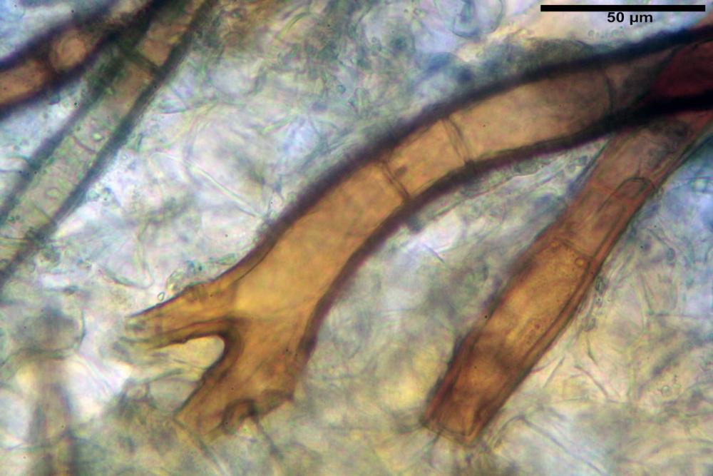 Scutellinia subhirtella 7482 17.jpg