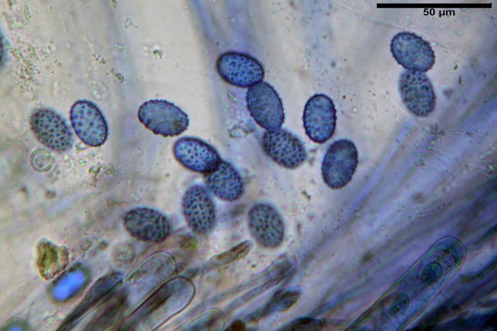 Scutellinia subhirtella 7482 41.jpg