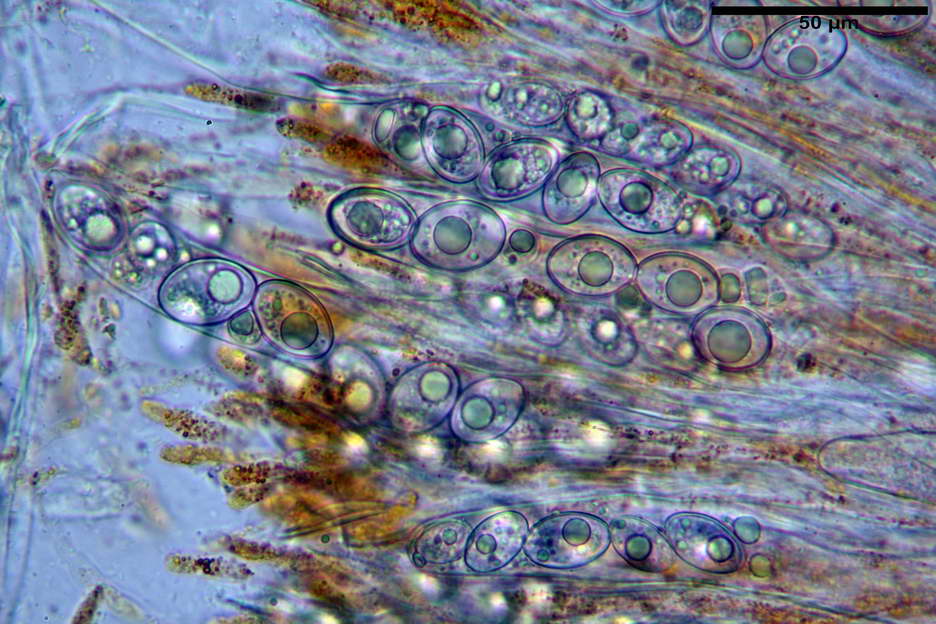 octospora roxheimii 4825 20.jpg