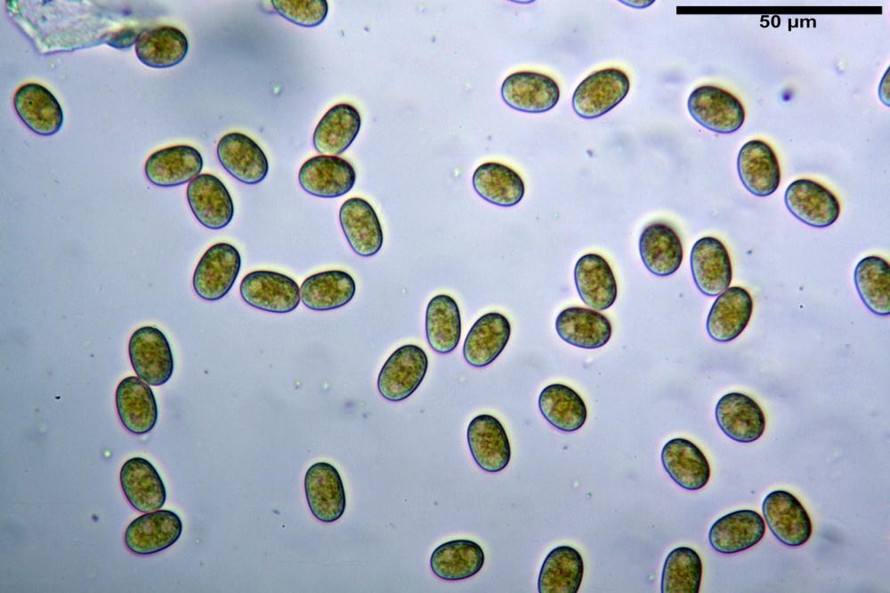 pilobolus crystallinus var kleinii 20_resize.jpg