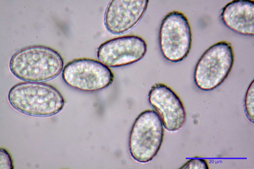 scutellinia 61.jpg