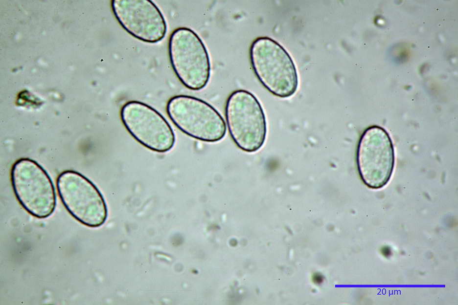 peziza subviolacea 4827 29.jpg