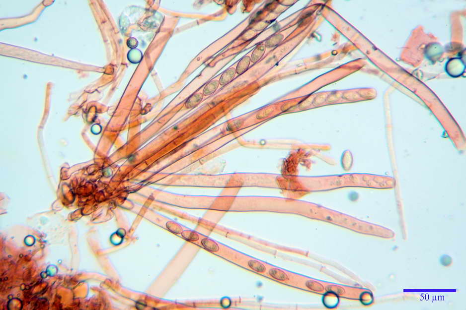 peziza badioides 4670 23.jpg