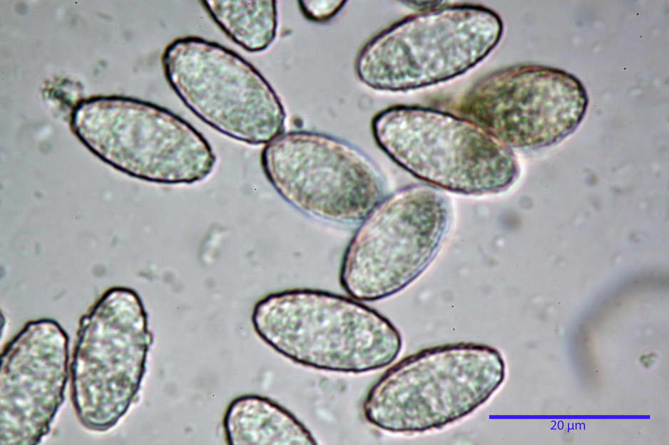 peziza badioides 4670 51.jpg