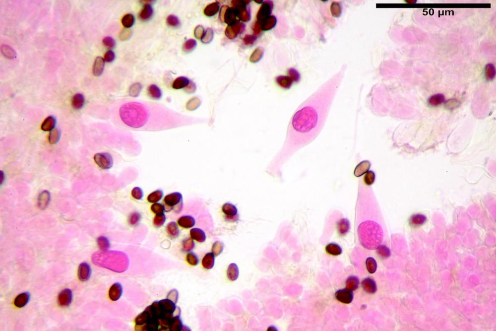Typhrasa gossypina 5342 16.jpg
