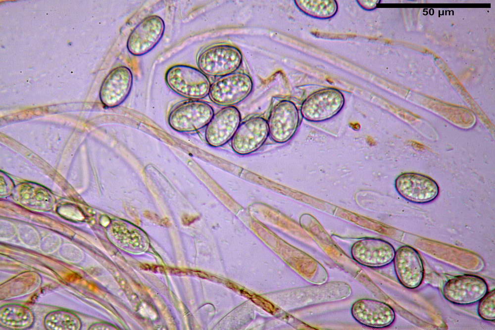 scutellinia crinita 25.jpg