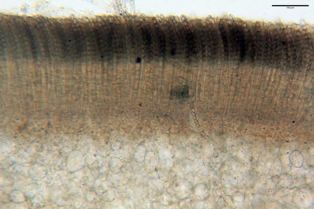2 peziza echinospora dall'alto imenio, subimenio- excipulum medullare superiorexci.jpg