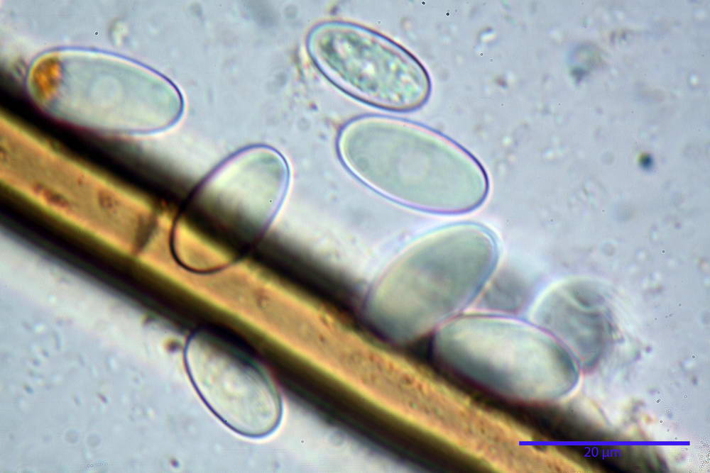 cheilimenia stercorea 4900 50.jpg