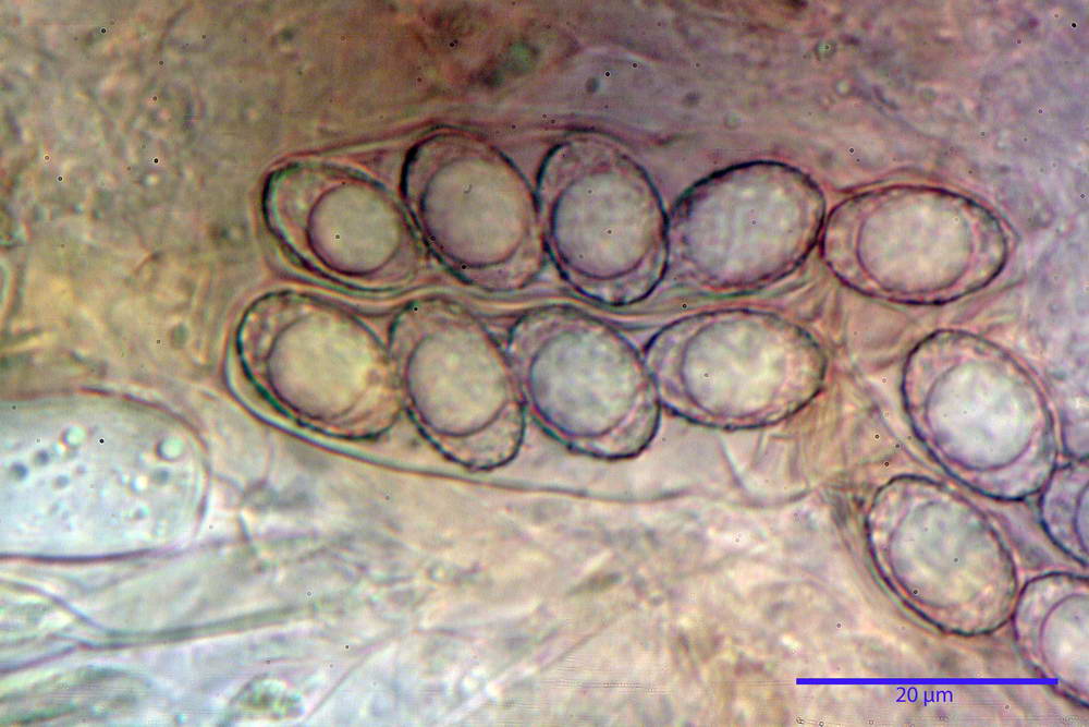 peziza saccardoana 5033 73.jpg