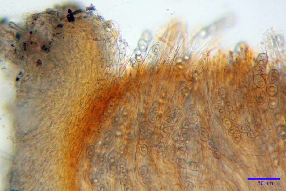 octospora roxheimii 4825 07.jpg