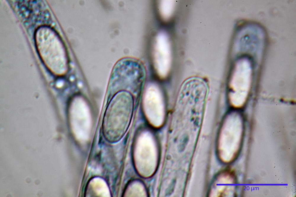 cheilimenia stercorea 4900 60.jpg