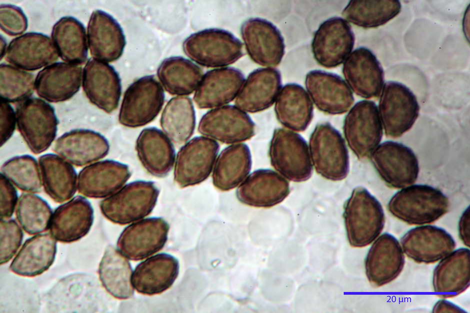 lacrymaria pyrotricha 4812 59.jpg