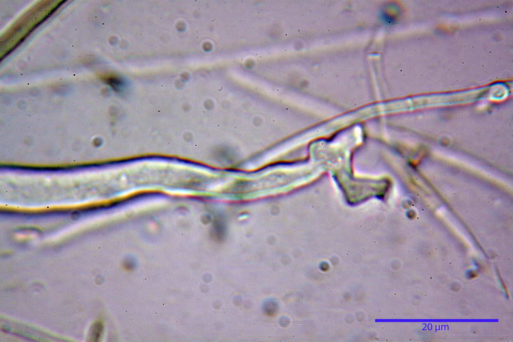 pseudoplectania nigrella 5040 05.jpg