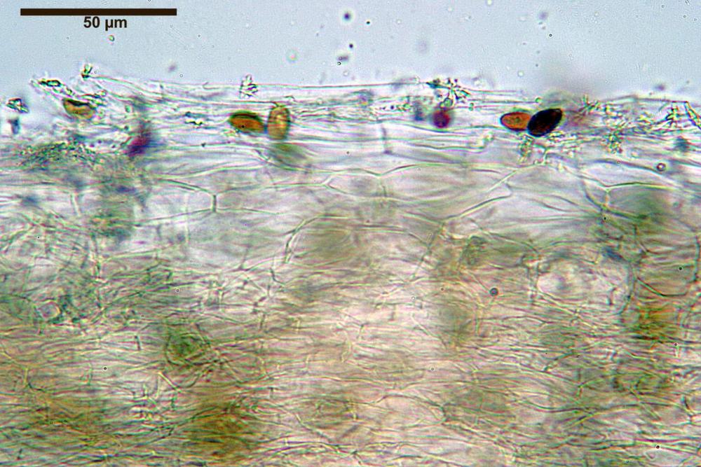 Coprinopsis marcescibilis pileipellis 03.jpg