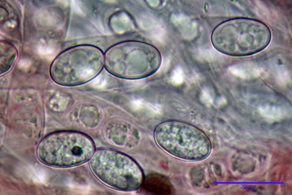 scutellinia subhirtella 4568 48.jpg