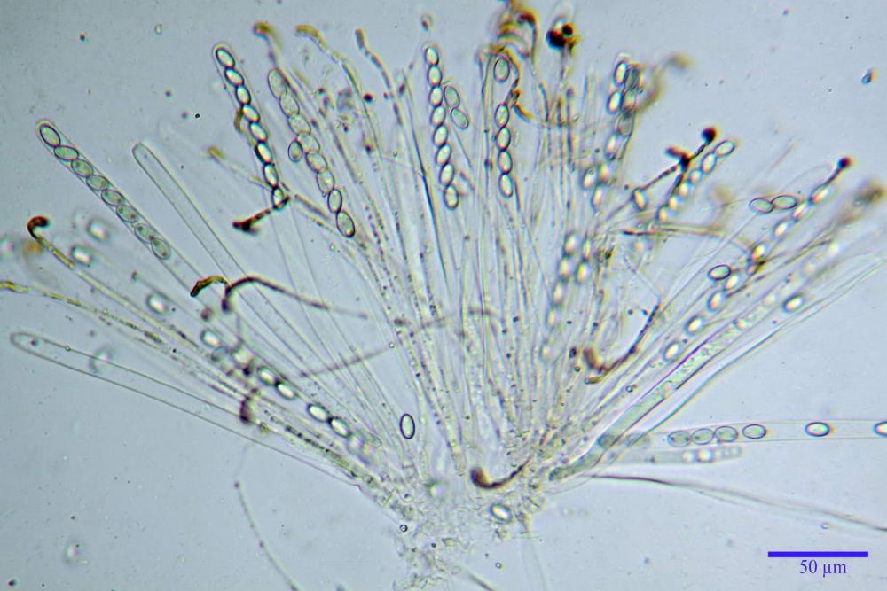 6 peziza subviolacea aschi e parafisi H2O.jpg