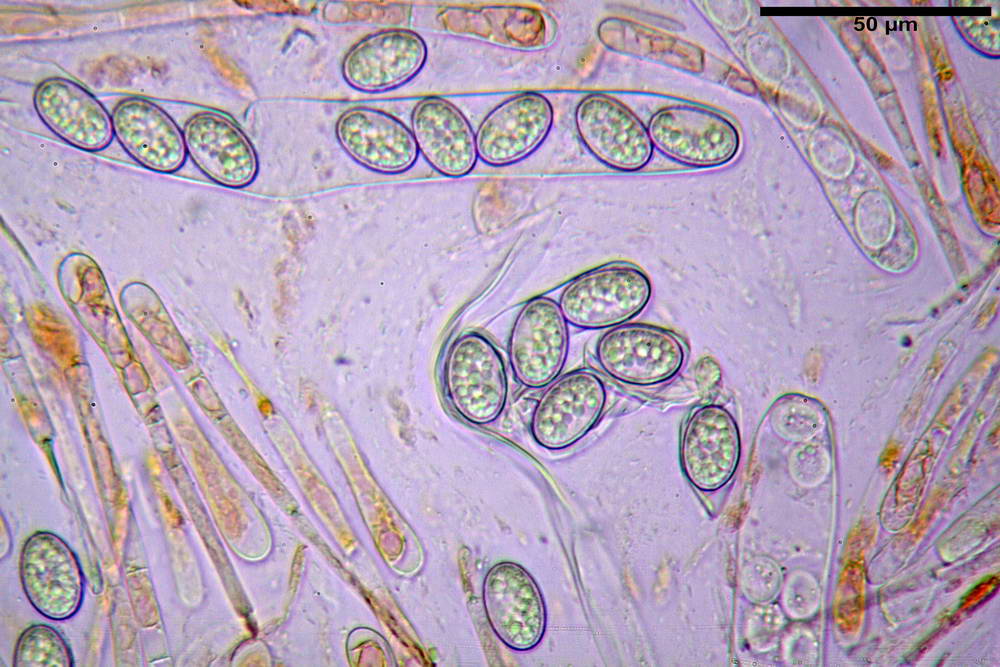 scutellinia crinita 26.jpg