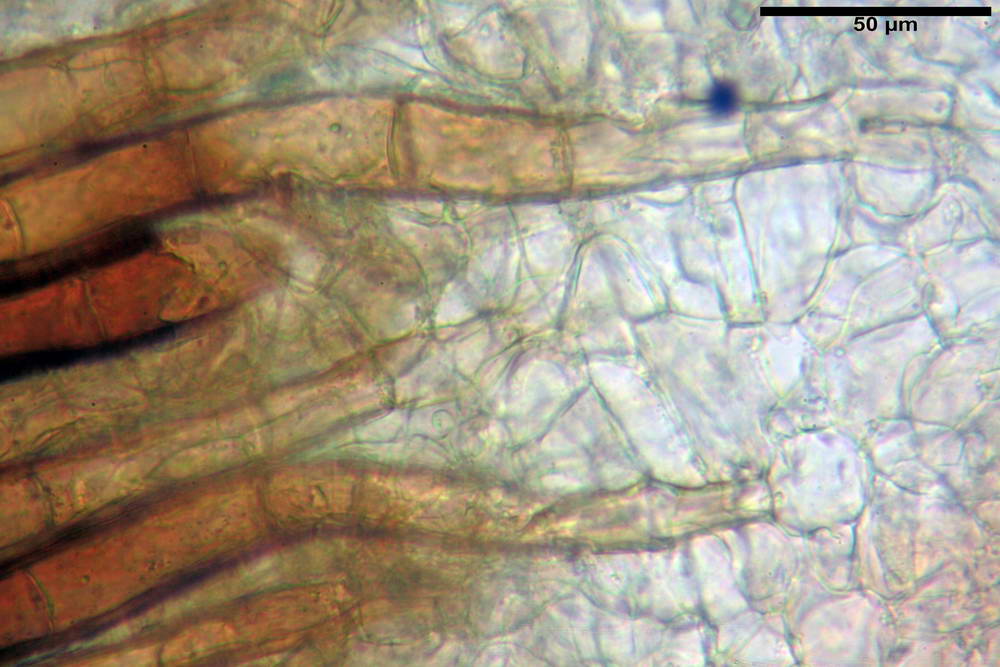 scutellinia superba 5075 29.jpg