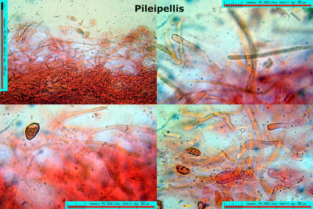 Hebeloma ochroalbidum pileipellis.jpg