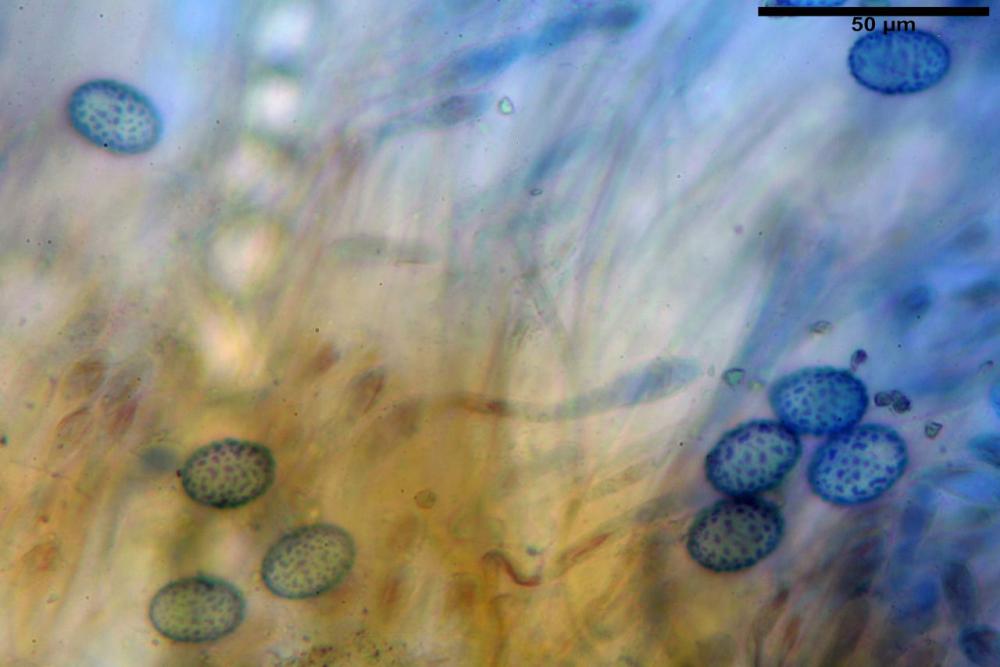Scutellinia subhirtella 7482 54.jpg