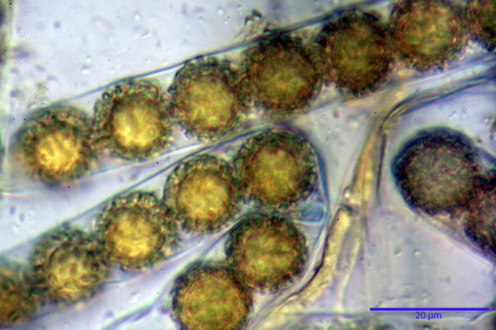 Plicaria trachycarpa 6920 39.jpg