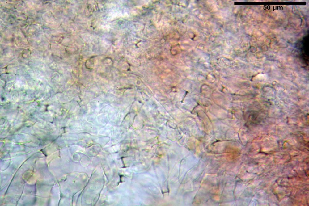 Plicaria trachycarpa 6920 09.jpg