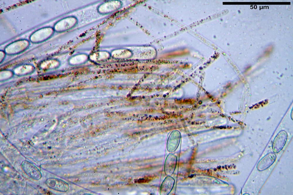 cheilimenia stercorea 4900 44.jpg