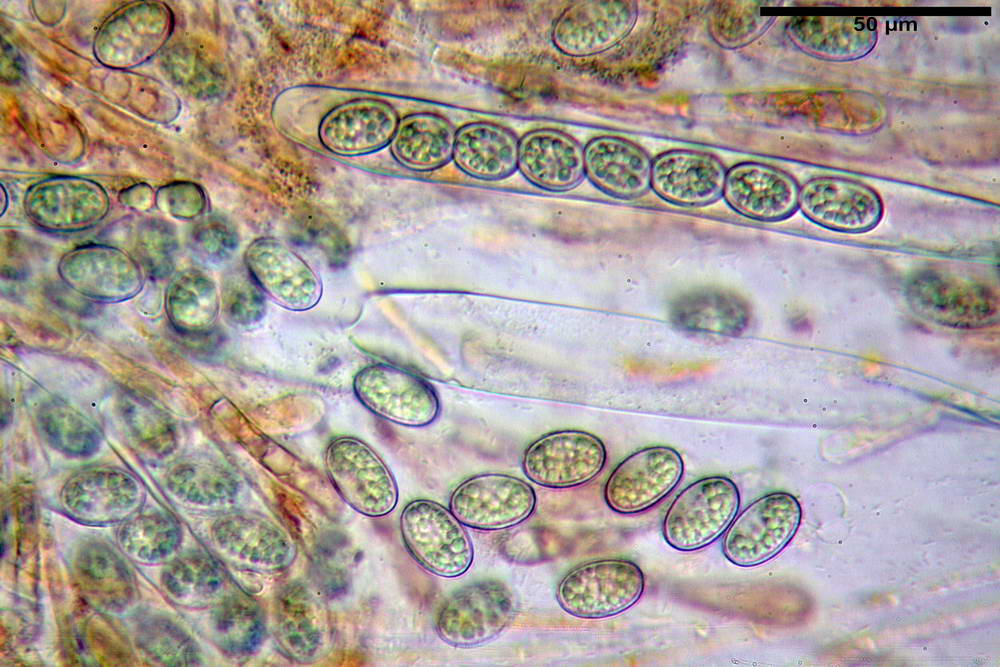 scutellinia crinita 24.jpg