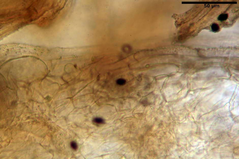 lacrymaria pyrotricha 4812 13.jpg