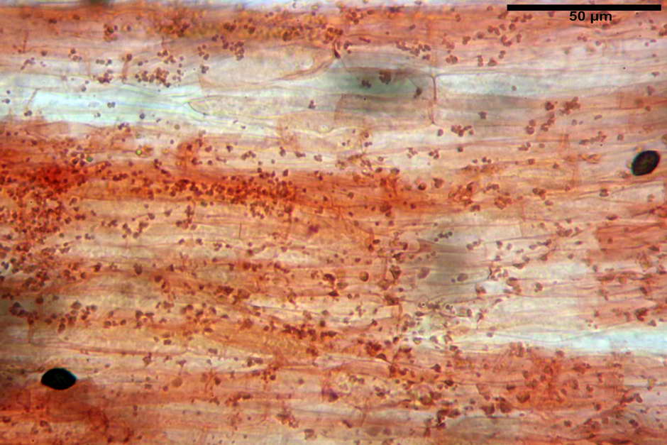 lacrymaria pyrotricha 4812 78.jpg