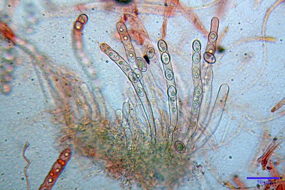 octospora roxheimii 4825 16.jpg
