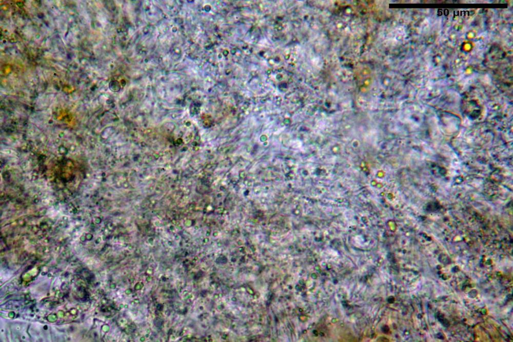 Scutellinia subhirtella 7482 28.jpg