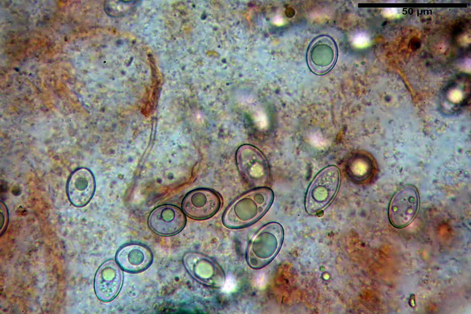 octospora roxheimii 4825 23.jpg