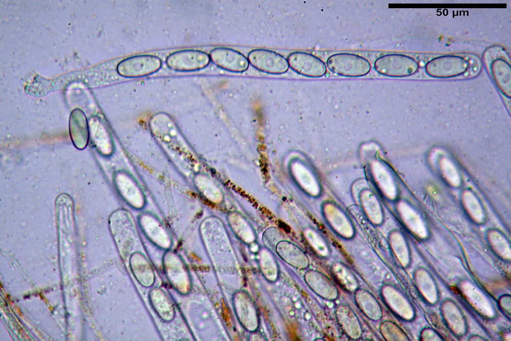 cheilimenia stercorea 4900 42.jpg