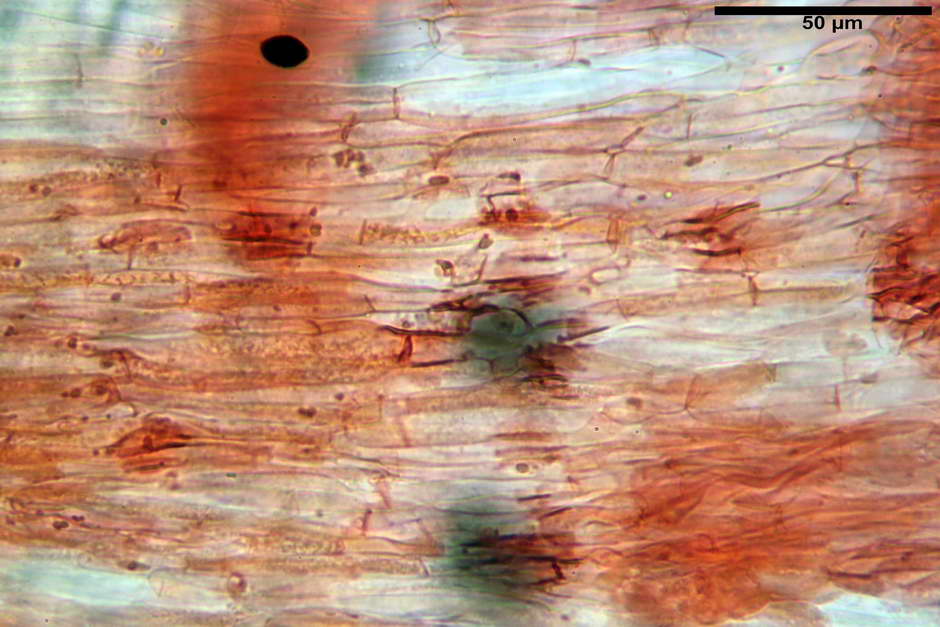 lacrymaria pyrotricha 4812 79.jpg