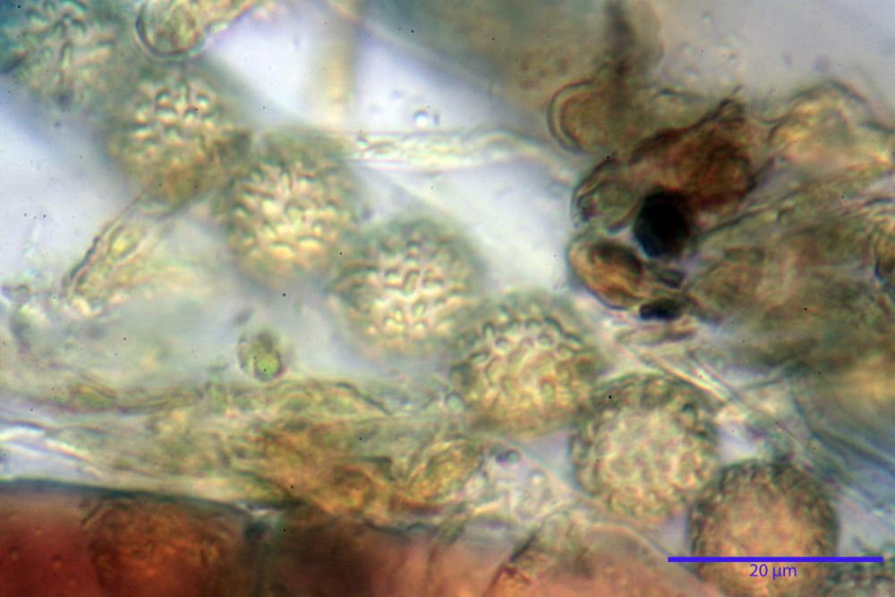 Plicaria trachycarpa 6920 38.jpg