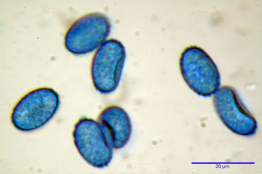 scutellinia 51.jpg