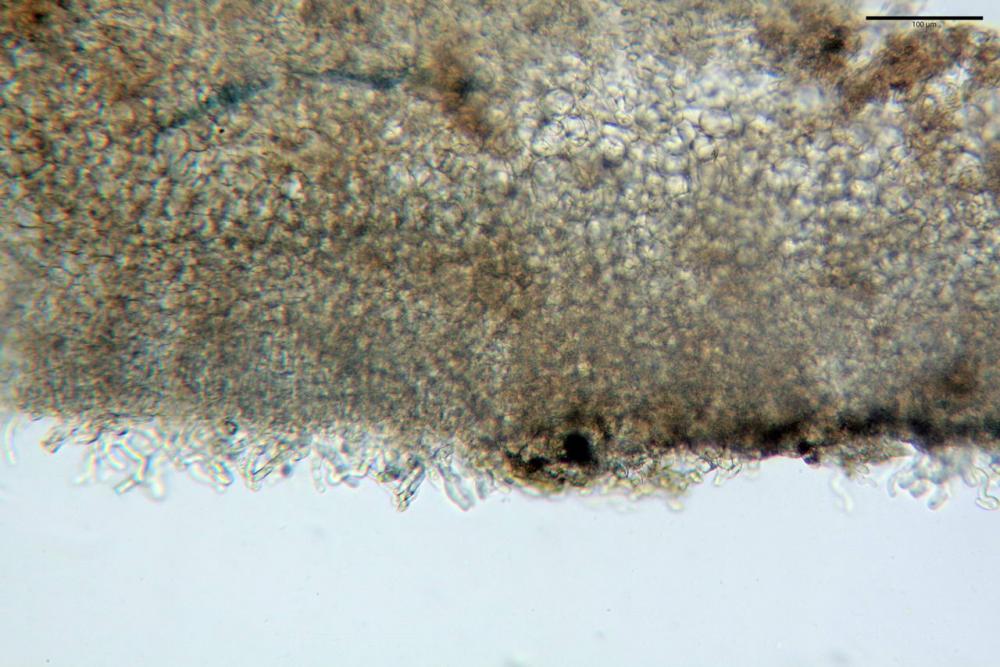 4 peziza echinospora dall'alto exc. medullare medio - exc. medullare inferiore - exc. ectale.jpg