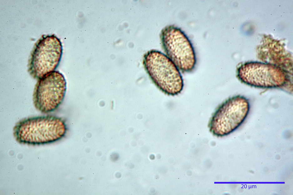 peziza echinospora 4826 46.jpg