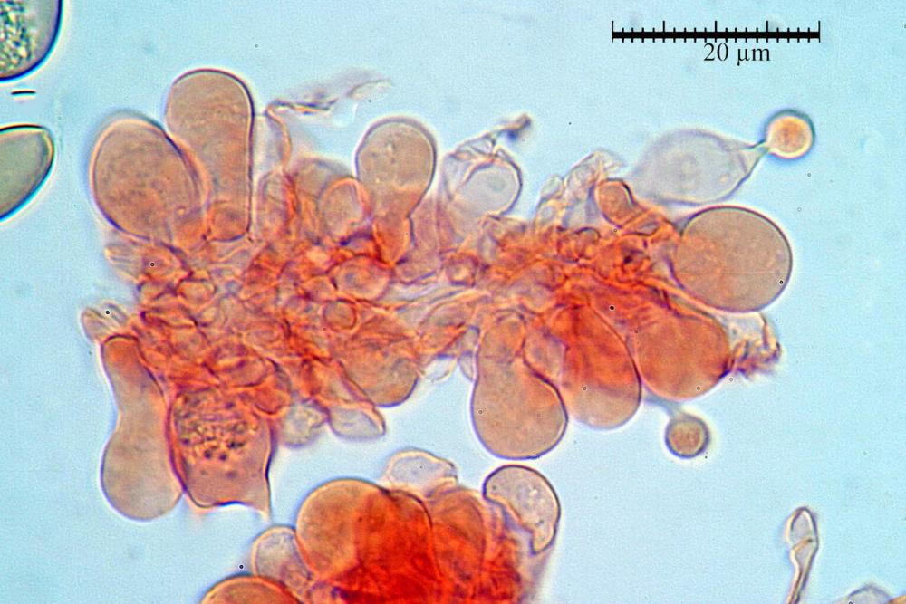conocybe inocybeoides cheilocistidi120.jpg