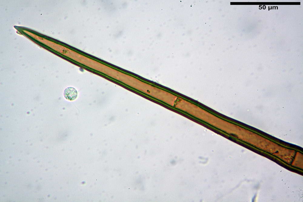 cheilimenia stercorea 4900 28.jpg