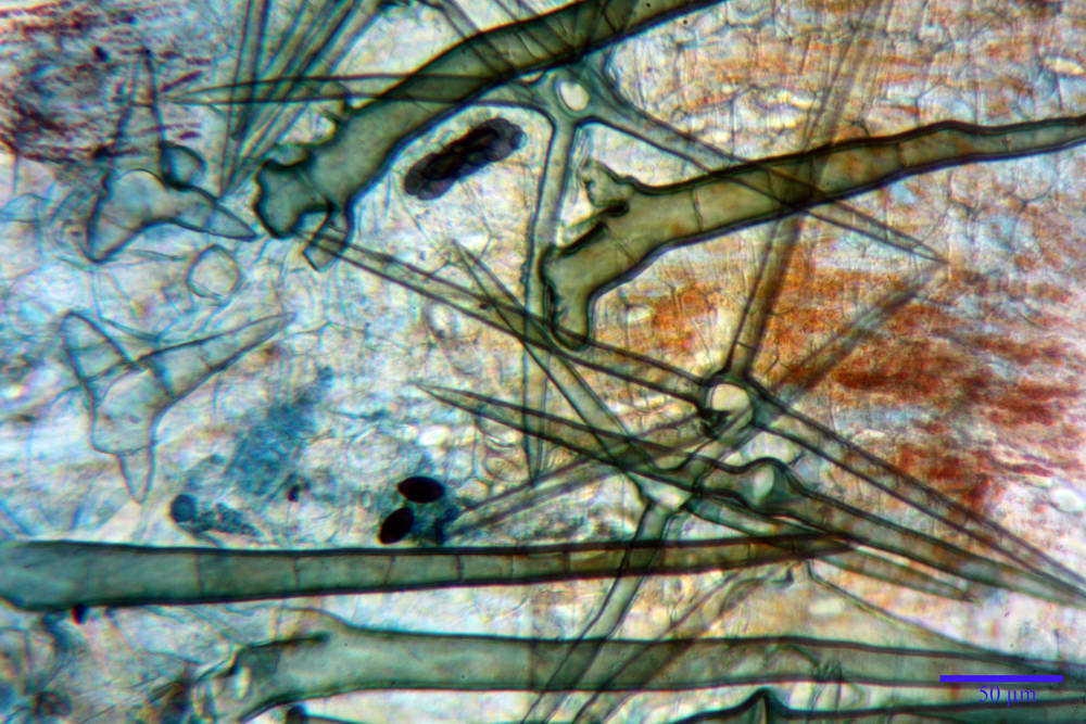 cheilimenia stercorea 4900 58.jpg