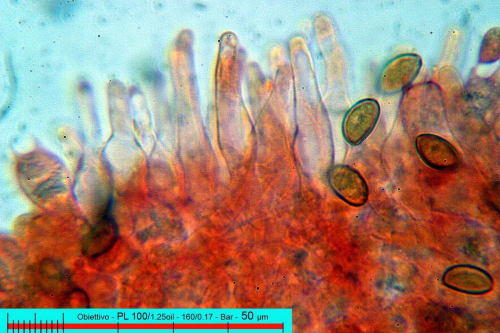 pholiotina aeruginosa 2955 cheilocistidi 03.jpg