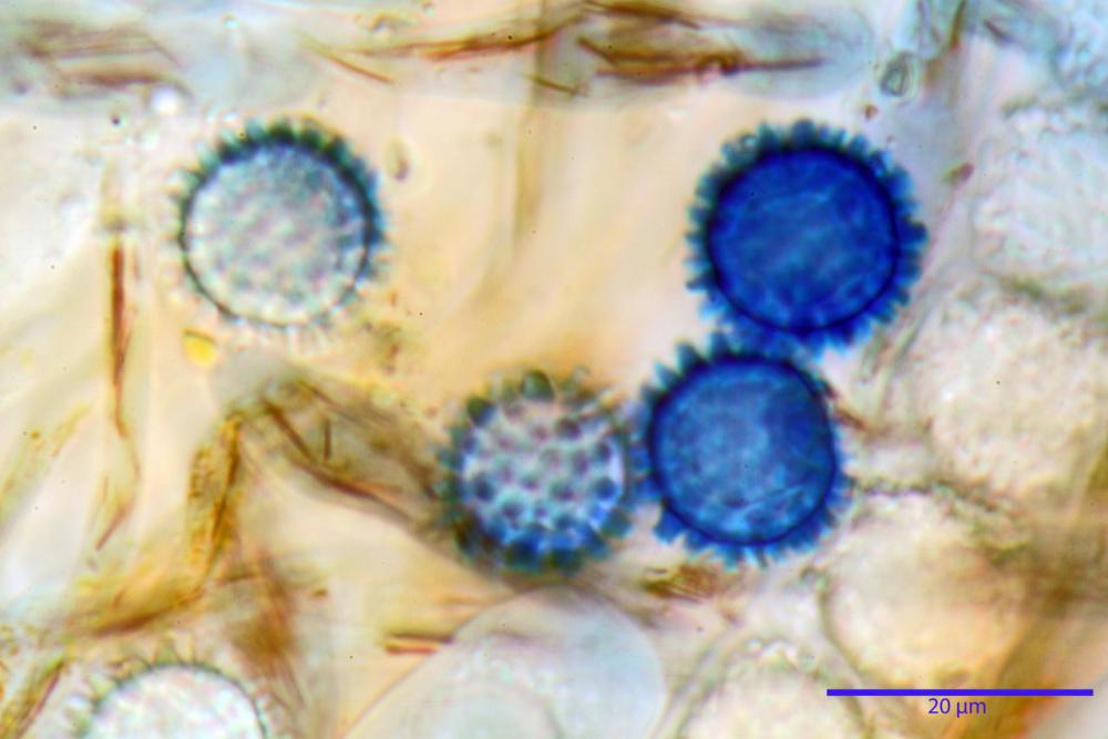 scutellinia trechispora 5343 16.jpg