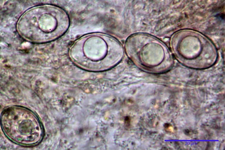 octospora roxheimii 4825 27.jpg