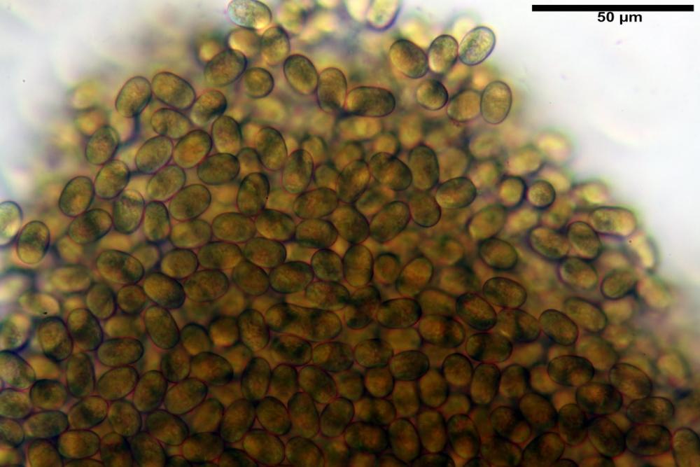 pilobolus crystallinus var kleinii 17_resize.jpg