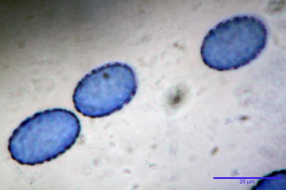 Scutellinia subhirtella 7482 62.jpg