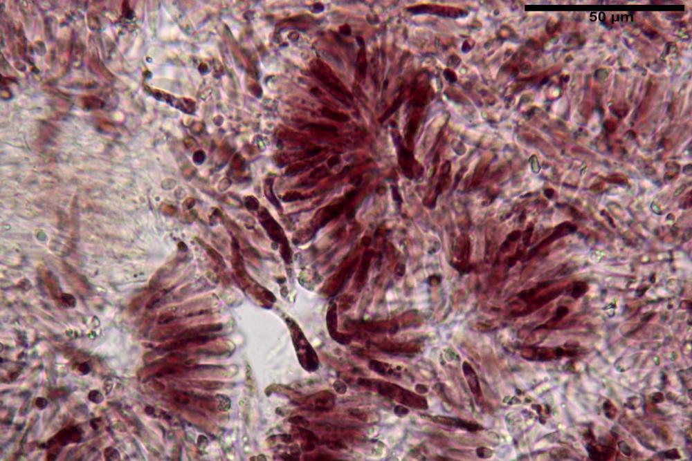 imenio luteo-olivaceum 5800 seccoKOH 2%.JPG